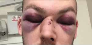 alex tait lightcliffe cricket